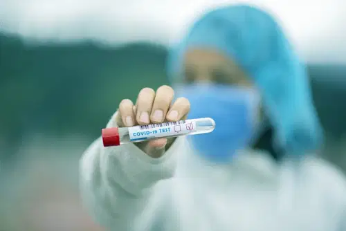 Do danes v raziskavi o razširjenosti novega koronavirusa še brez pozitivnega vzorca