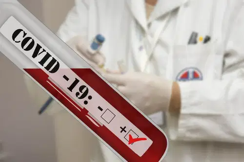 Beovićeva: Epidemiološka slika je še vedno nejasna, treba bo počakati tako z morebitnim sproščanjem kot zaostrovanjem ukrepov