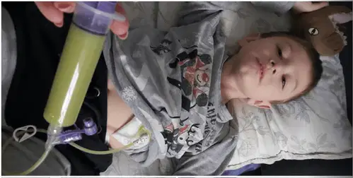 Gastrostoma mlademu Lovru iz Koroške in ostalim bolnikom rešuje življenje