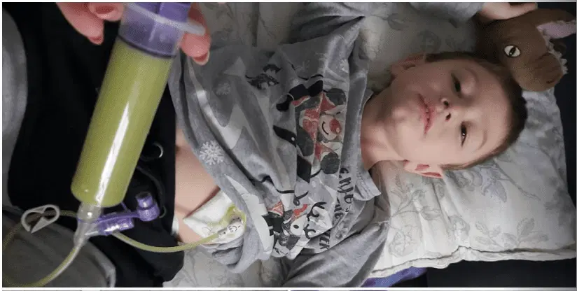 Gastrostoma mlademu Lovru iz Koroške in ostalim bolnikom rešuje življenje