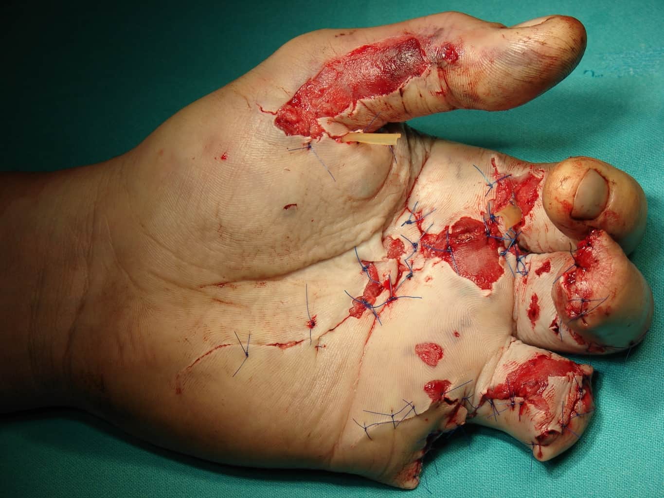 Iskra v srcu je svetlejša od vsakega ognjemeta. Bodi zvezda, ne meči petard