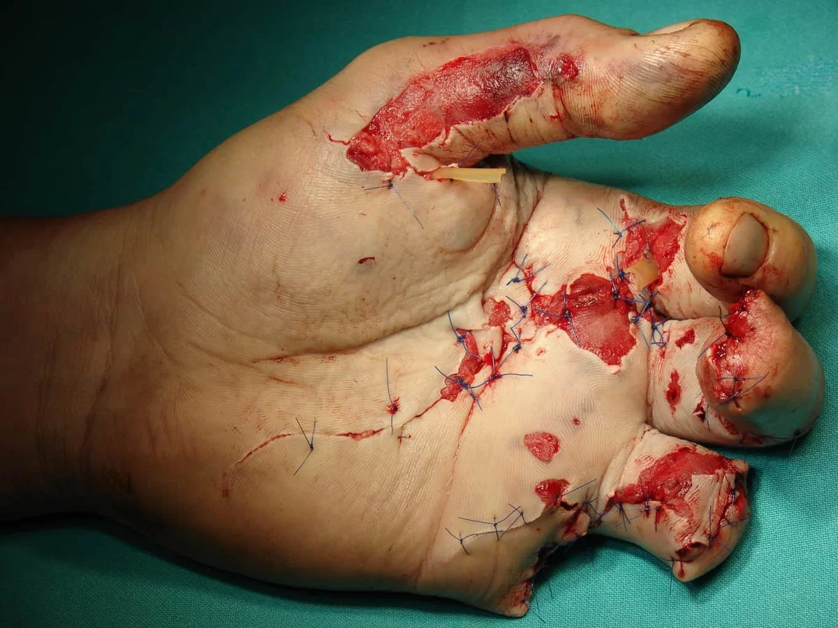 Iskra v srcu je svetlejša od vsakega ognjemeta. Bodi zvezda, ne meči petard