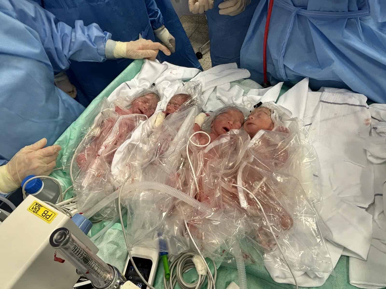 V ljubljanski porodnišnici rodila četverčke