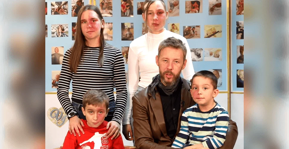 Božična zbiralna akcija za nakup PDL laserja: Pomagajmo otrokom in mladostnikom z ognjenim znamenjem #video