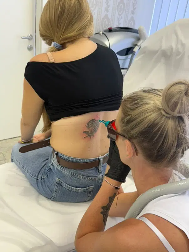 Salon Omorfia: Prvi s tehnologijo PhiLaser na Koroškem